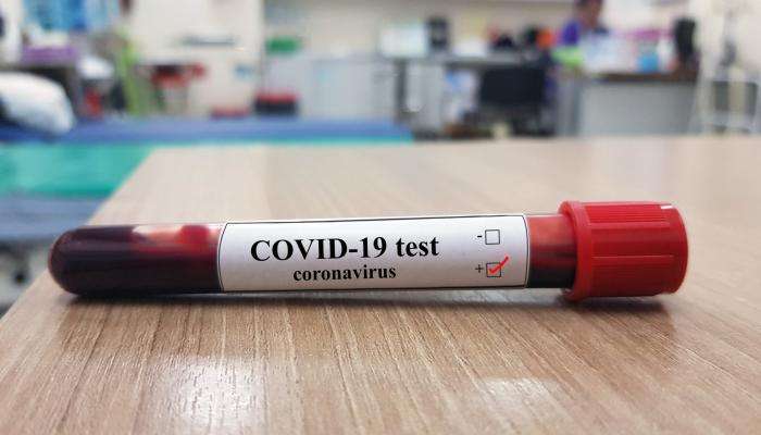 Tunisia Records 6 New Coronavirus Cases